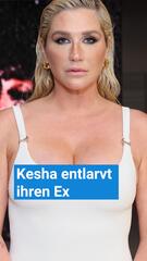 Kesha entlarvt ihren Ex: Der wahre Grund für die Trennung!