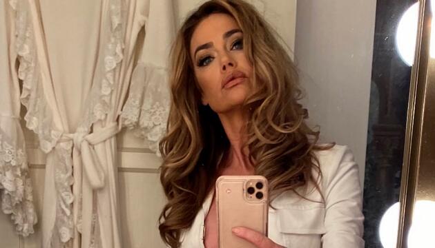 Denise Richards zeigt Facelift-Verwandlung