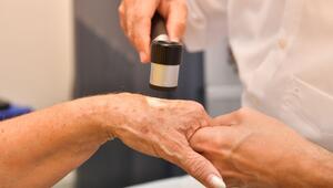 Dermatologe untersucht Altersflecken auf der Hand einer Frau