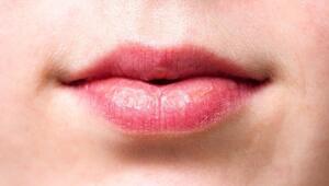 dicke lippe