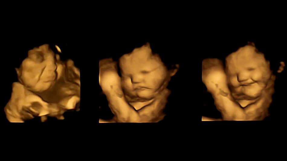 Ultraschall-Studie zeigt: Kinder hassen grünes Gemüse schon im Mutterleib