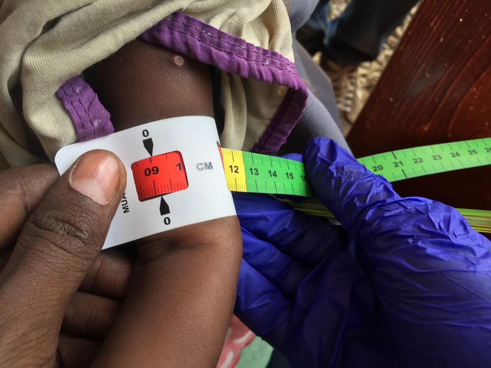 Tausende Kinder in Nord Darfur von Hungertod bedroht