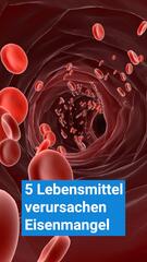 5 Lebensmittel verursachen Eisenmangel