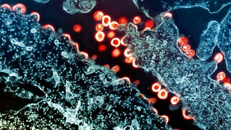 HIV Virus