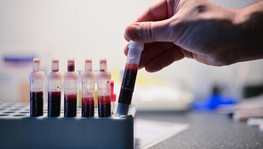 HIV Test Blut