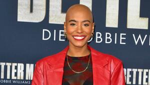 Sharon Battiste trägt seit 2022 eine Glatze. Bereits seit der Kindheit leidet sie an kreisrundem ...