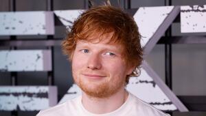 So sieht Ed Sheeran jetzt nicht mehr aus.