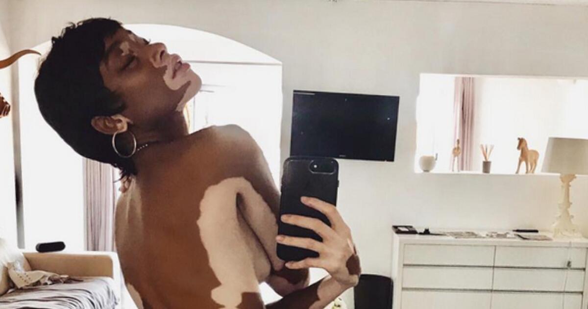 Dieses Nackt-Selfie macht Mut! - Video | GMX.AT