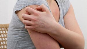 Eine Frau kratz sich am Oberarm