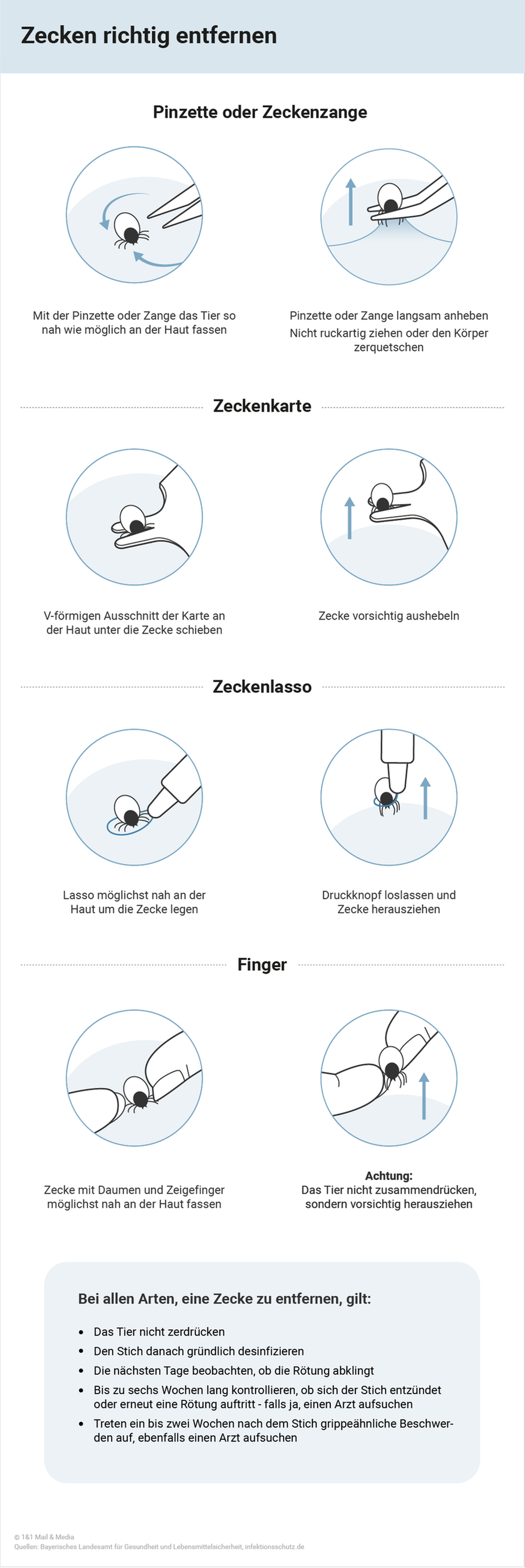 Zecken richtig entfernen