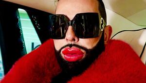 Harald Glööckler zeigt sich radikal verändertet