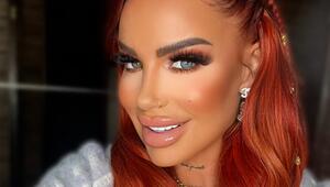 Nach Gewichtsverlust: Gina-Lisa Lohfink investiert 6.000 Euro in ihr Gesicht