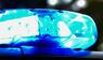 Ein Schweizer soll im Thurgau einen Tiroler getötet haben