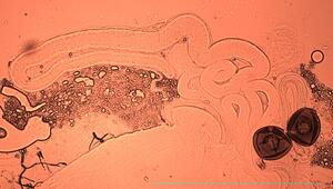 Regelmäßiges Ejakulieren steigert männliche Fruchtbarkeit