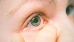 Eine Frau leidet unter einer Entzündung am Auge