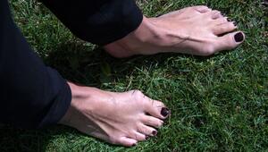 Füße einer Frau mit Zehenfehlstellung Hallux valgus