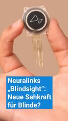 Neuralinks „Blindsight soll Blinden Sehkraft ermöglichen