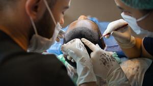 Haartransplantation