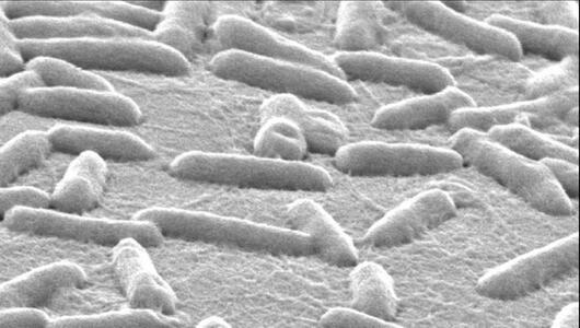 Pseudomonas-aeruginosa-Bakterien