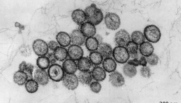 Hantavirus