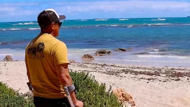 Finger ins Auge gedrückt: Surfer schildert Haiangriff in Australien